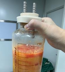 海北水动力吸脂手术要做多久？